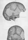 Early Skull from the Freedown, Ringwould, Kent.JPG (22343 bytes)